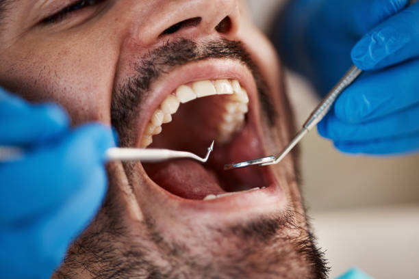 Best Emergency Dental Care for Broken or Chipped Teeth in Sturgis, SD
